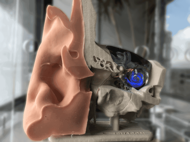 OCI human ear